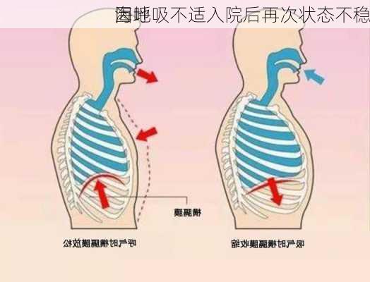 海地
因呼吸不适入院后再次状态不稳